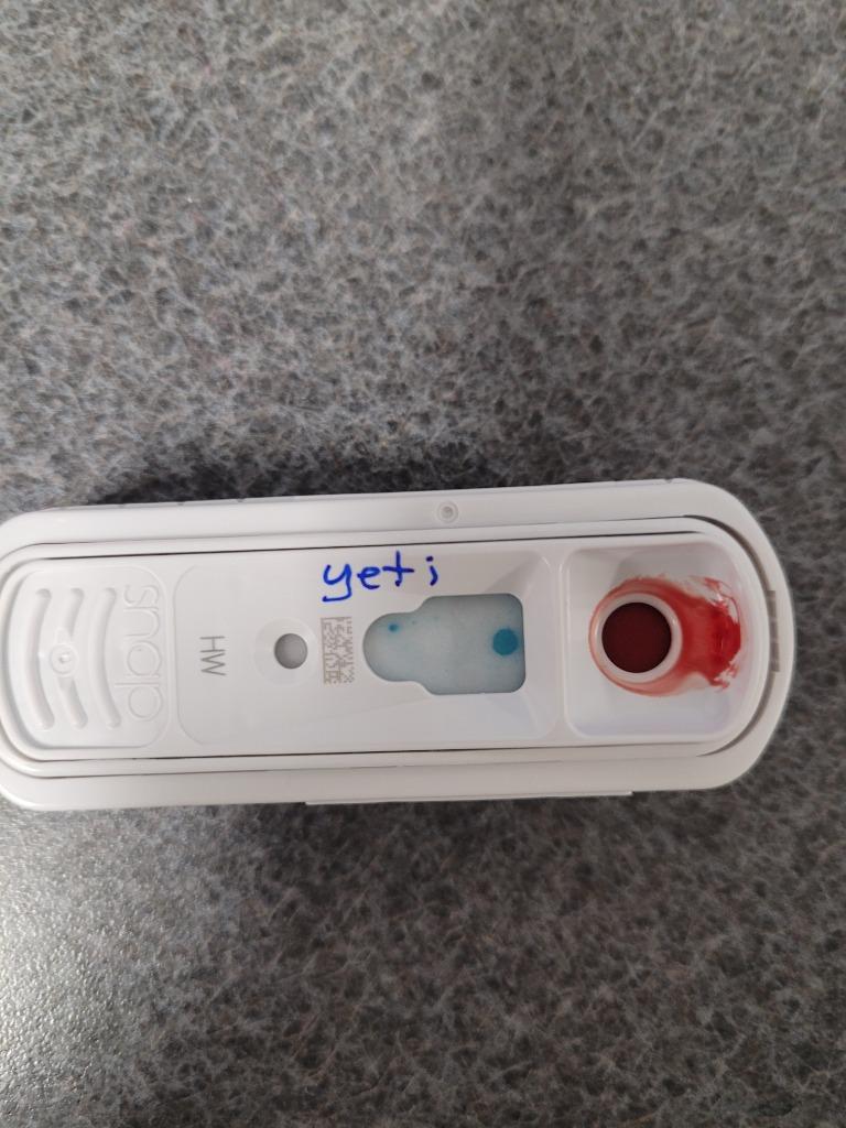 Yeti thumbnail 2