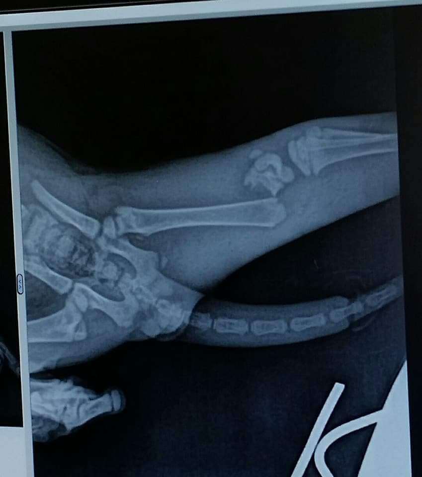 Miracle Ii thumbnail 5