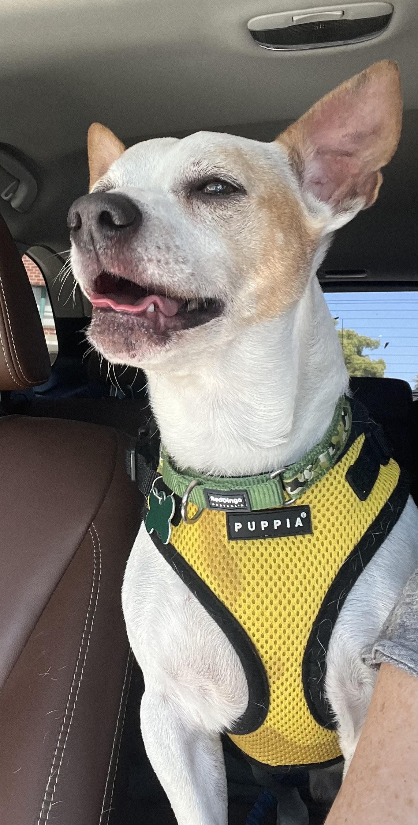 Radar