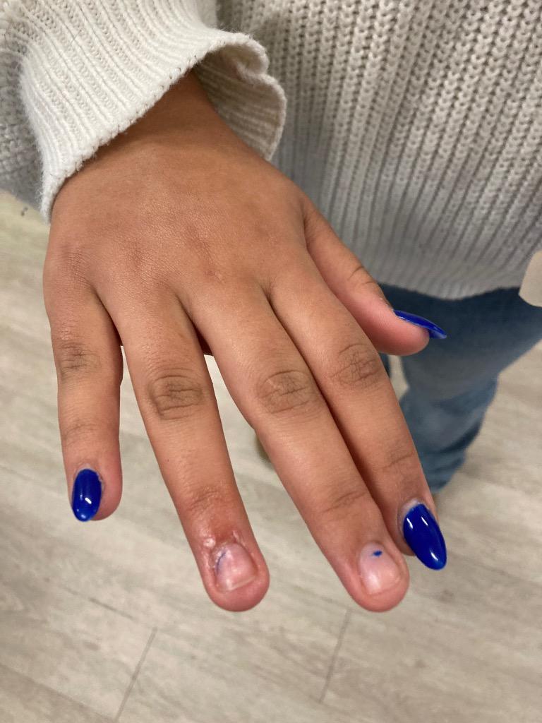 Enlarge January (Itchy), a Adoptable mixed breed in Meriden, CT image 2/5