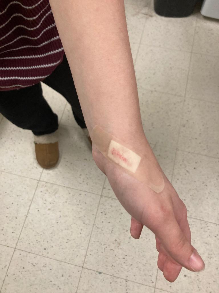 Enlarge January (Itchy), a Adoptable mixed breed in Meriden, CT image 5/5